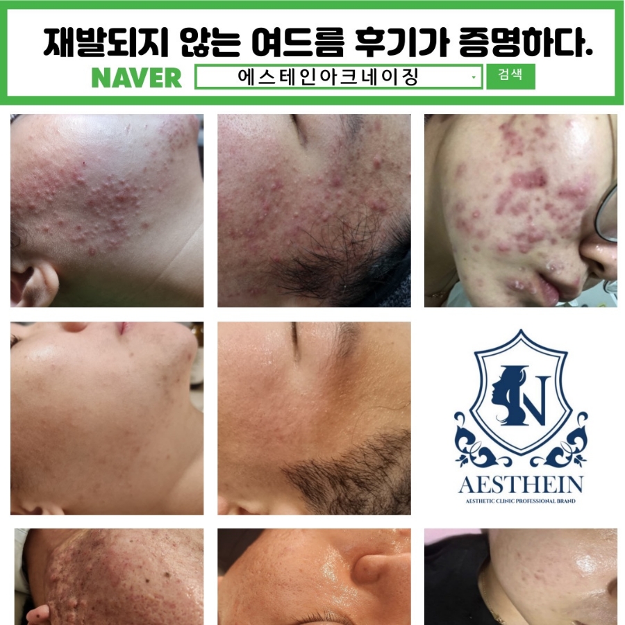 아미고에스테틱 이미지