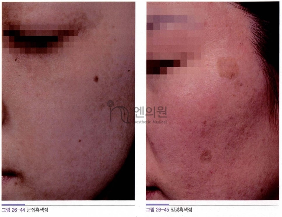 엔의원 이미지