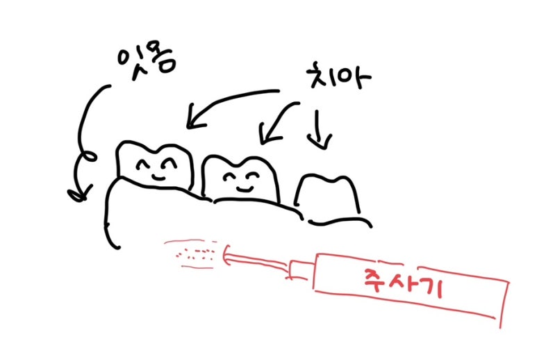 수성사랑니치과의원 이미지