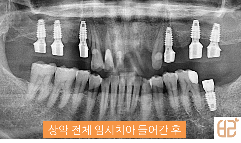 연세바른치과 이미지