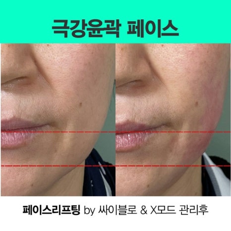 뷰티비젼 진주점 이미지