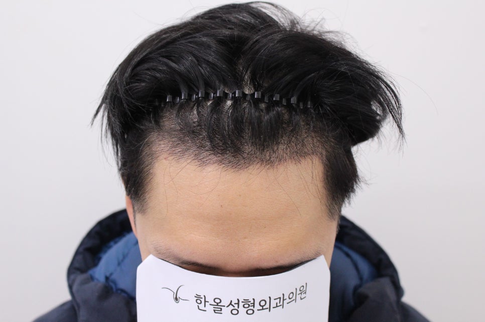 더헤어라인성형외과의원 이미지