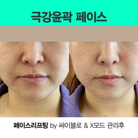뷰티비젼 진주점 이미지