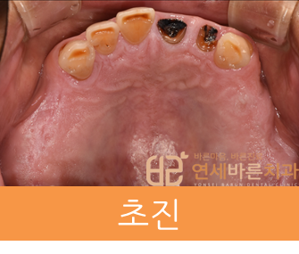 연세바른치과 이미지