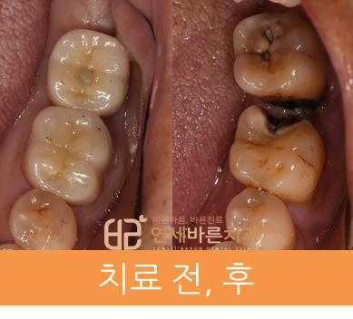 연세바른치과 이미지