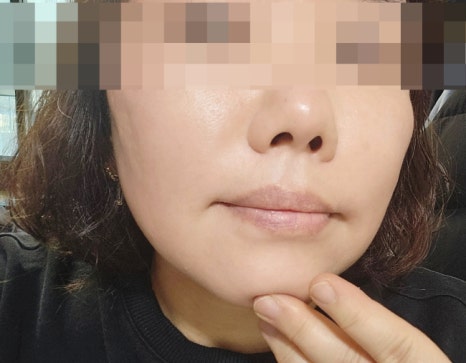 화이트 미 스킨케어 이미지