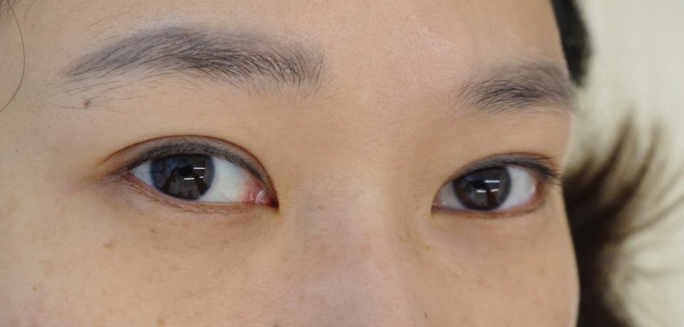더예쁜eye 이미지