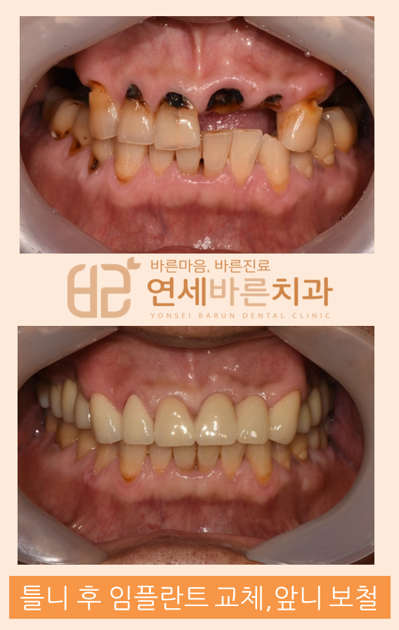 연세바른치과 이미지