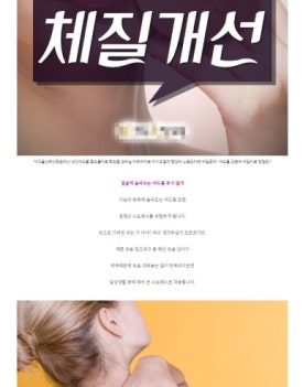시스토리 이미지