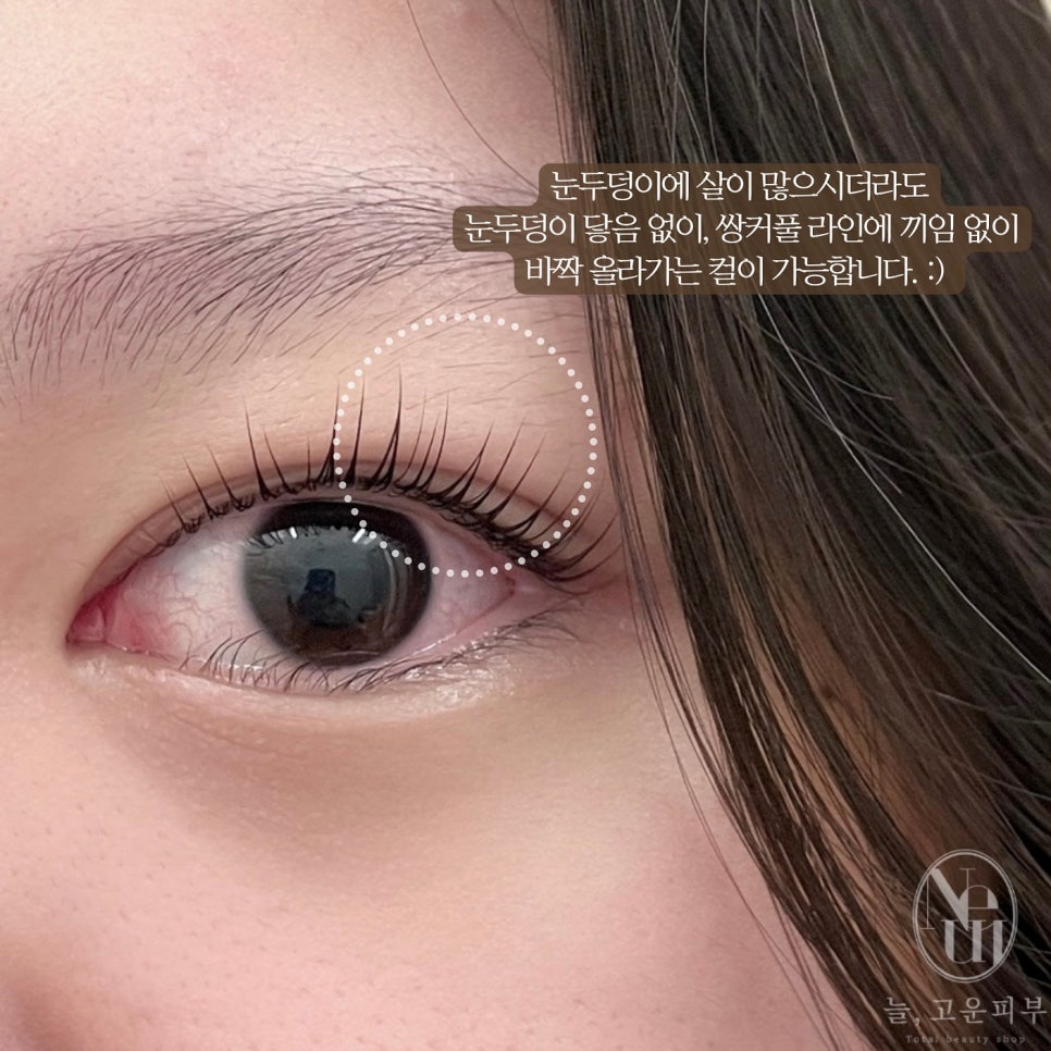 늘,고운피부 이미지