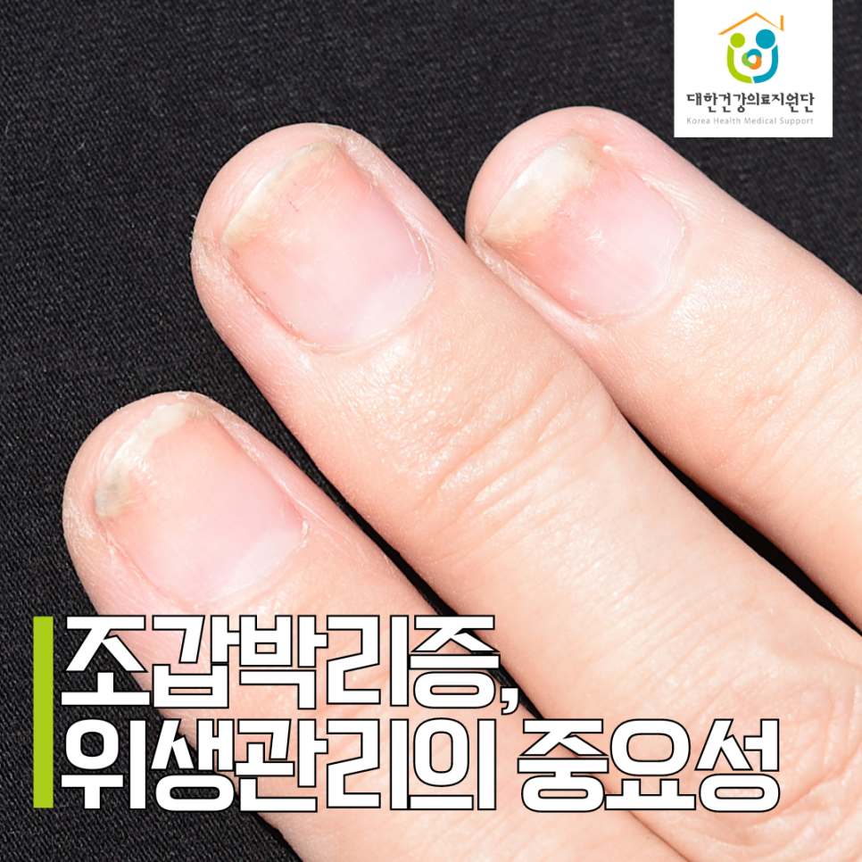 손톱발톱 이미지