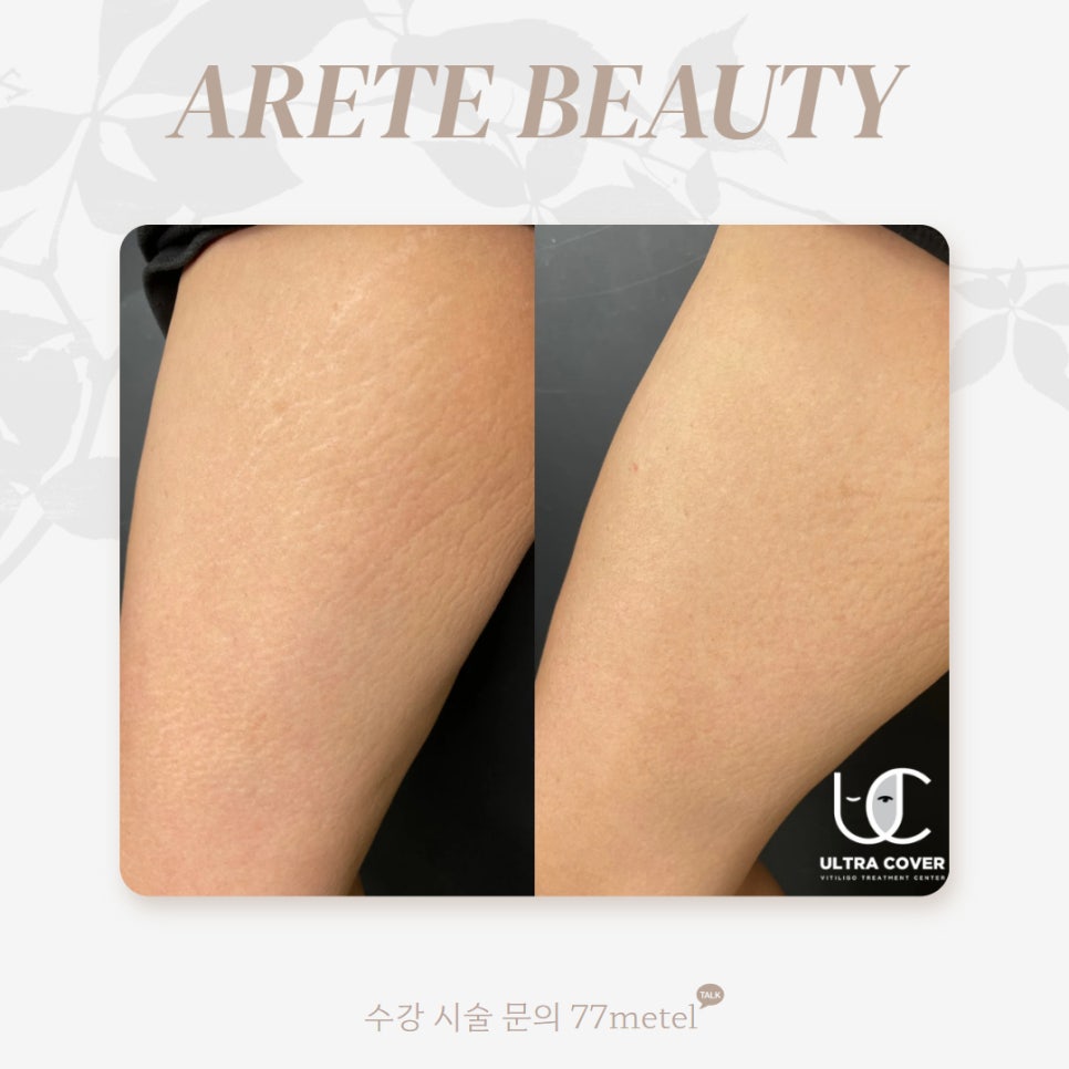 52아레테 이미지
