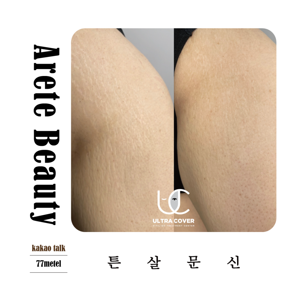 52아레테 이미지