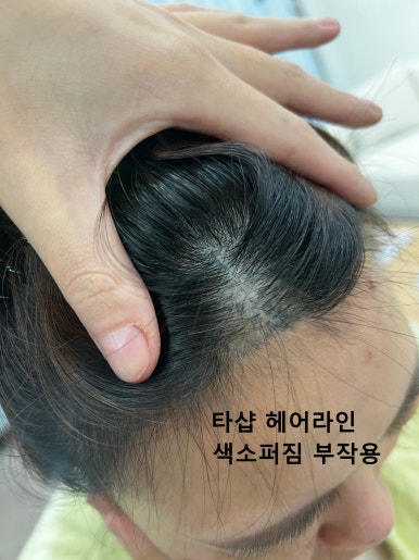 현헤어라인 이미지