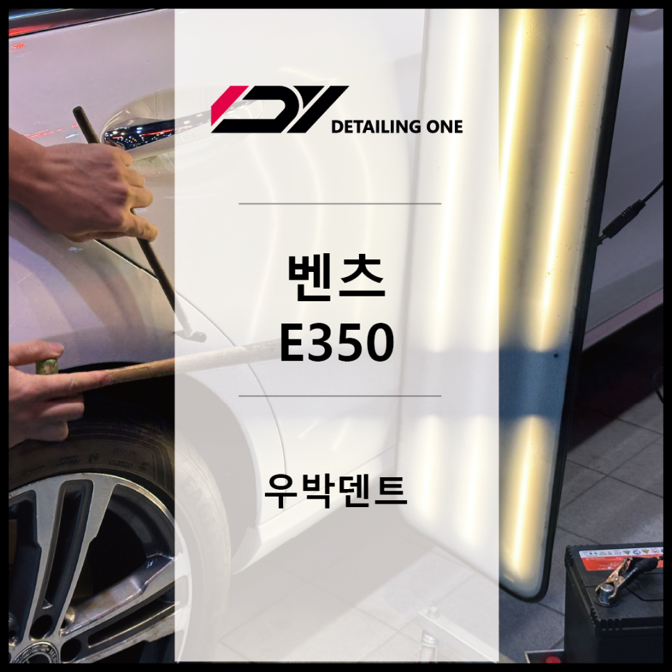 글로벌덴트 이미지