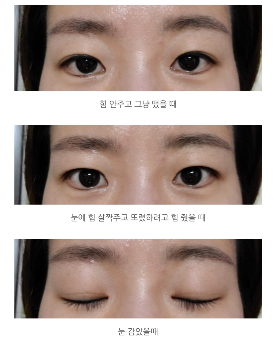 세인성형외과 이미지