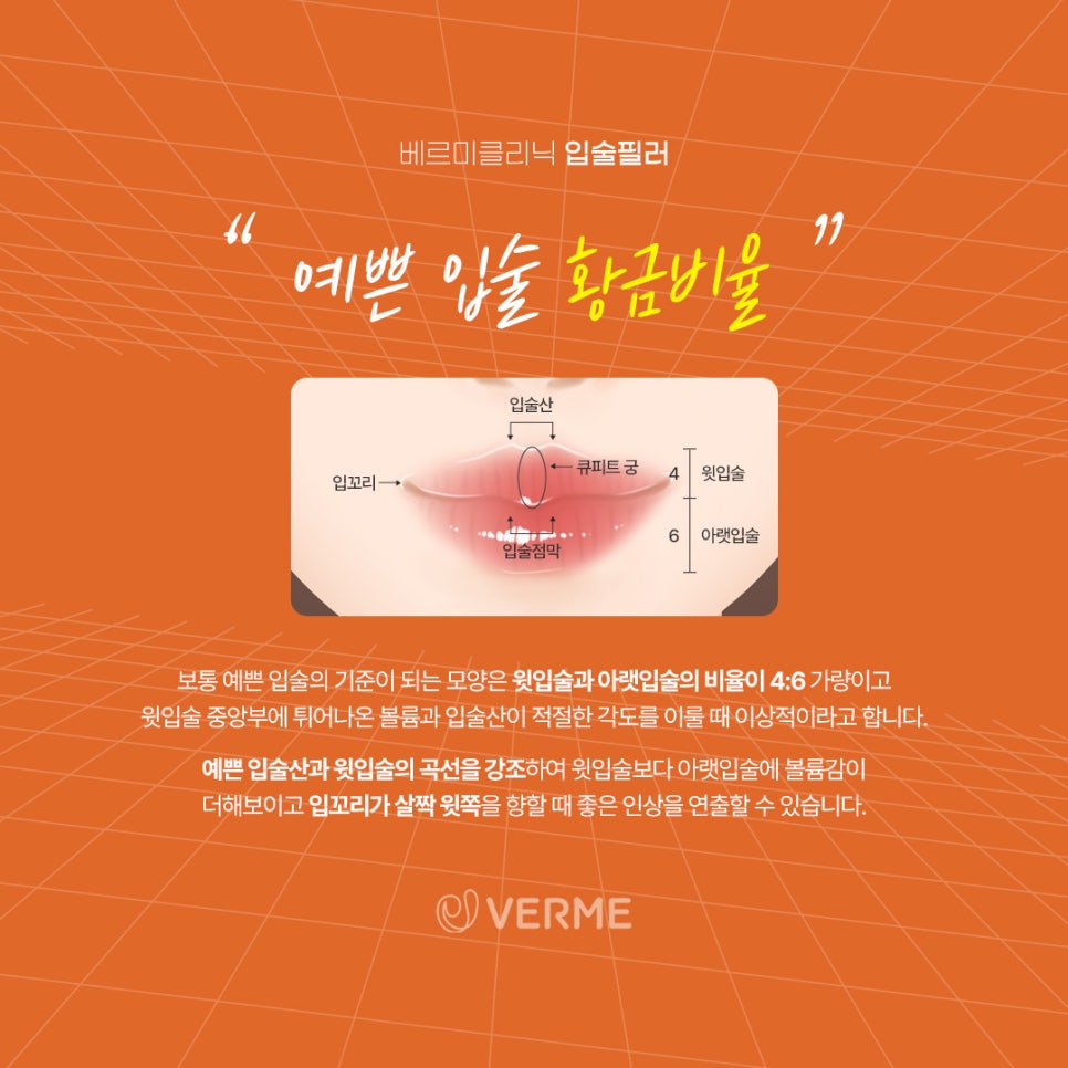 큐피트통상 이미지