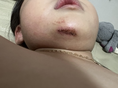 박종필성형외과 이미지