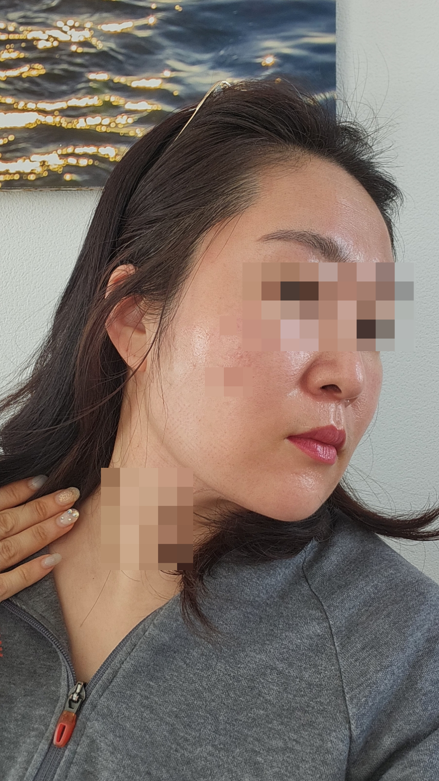 누보드스킨 이미지