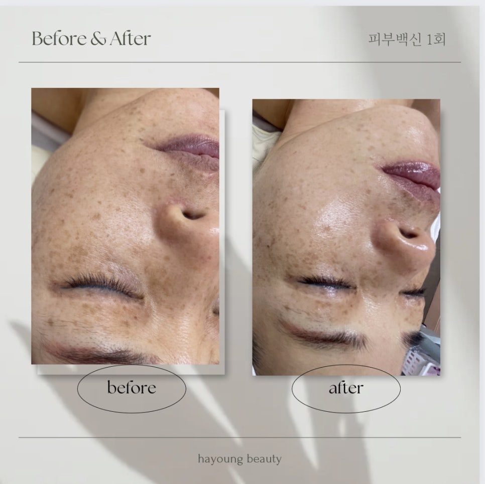 하영피부관리 이미지