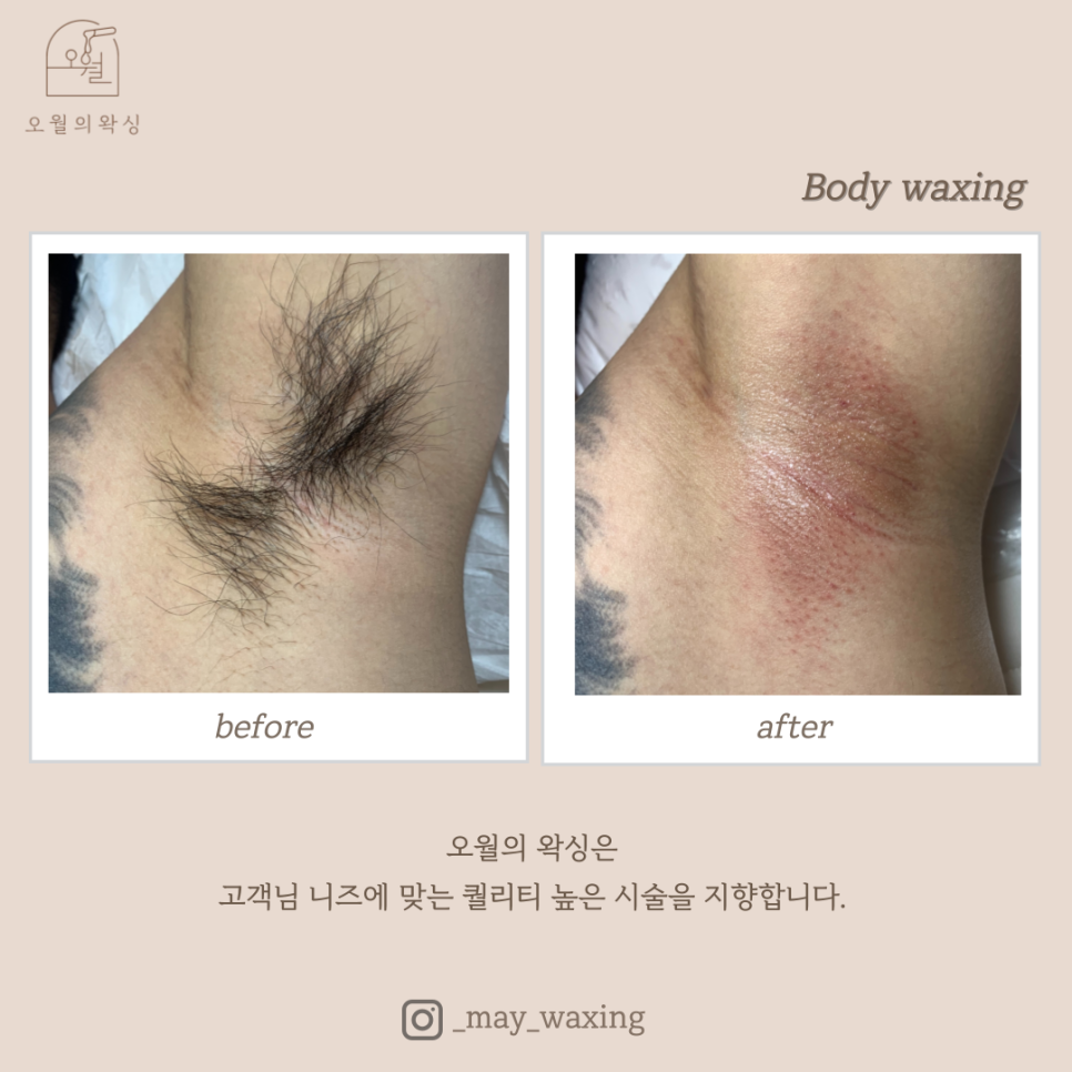 오월의 왁싱 이미지