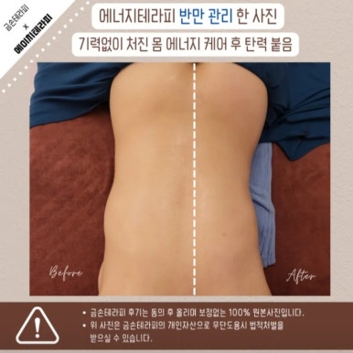 금손테라피 이미지