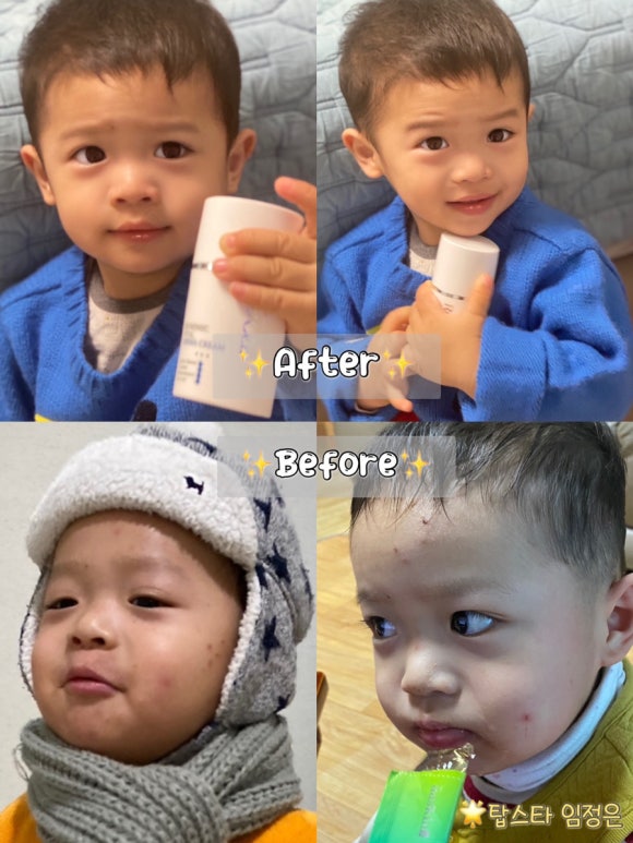 리셀라인 이미지