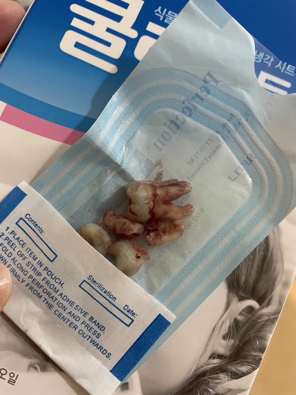 사랑니를부탁해치과 이미지