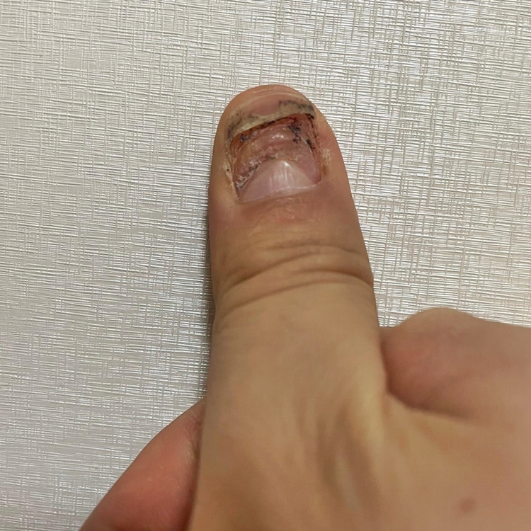 손톱가게 이미지