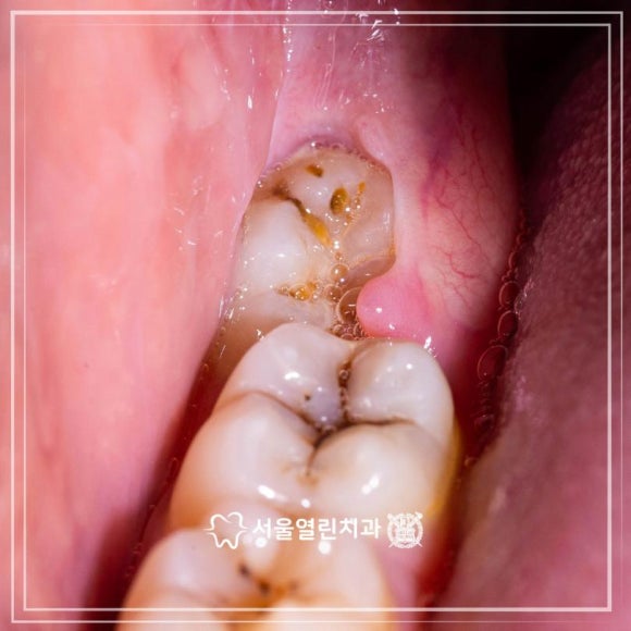 서울열린치과 이미지