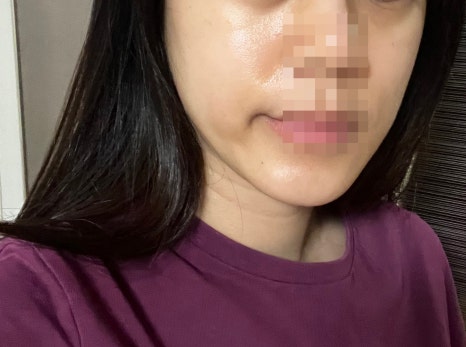 다올메디 이미지