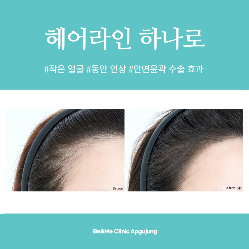 압구정M헤어 이미지