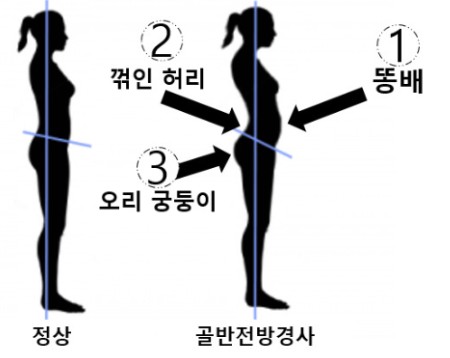 오리궁댕이 이미지