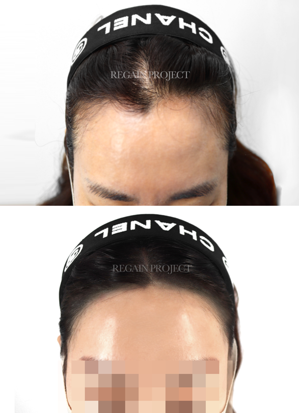 강남헤어이야기 이미지