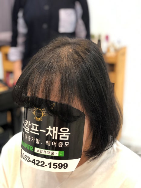 대구가발스칼프채움 이미지