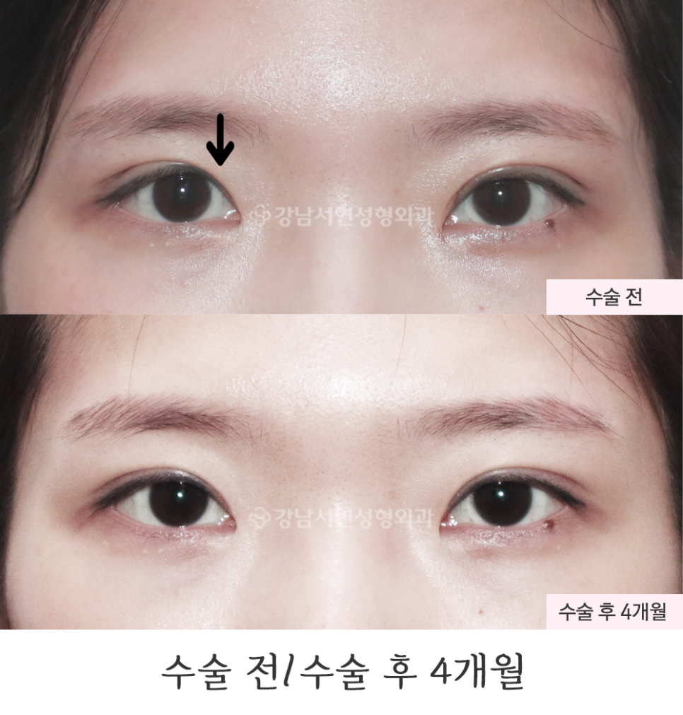 서연성형외과의원 이미지