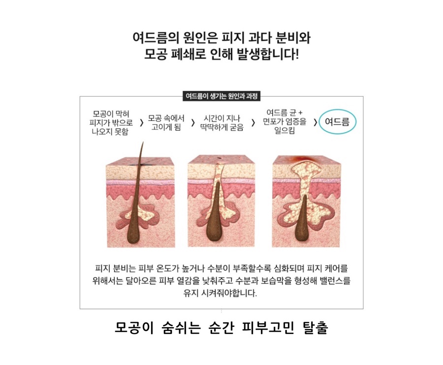 베카로움 이미지