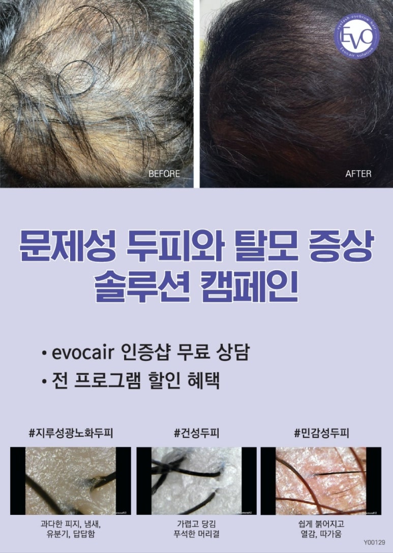 그리고;반하다83 이미지