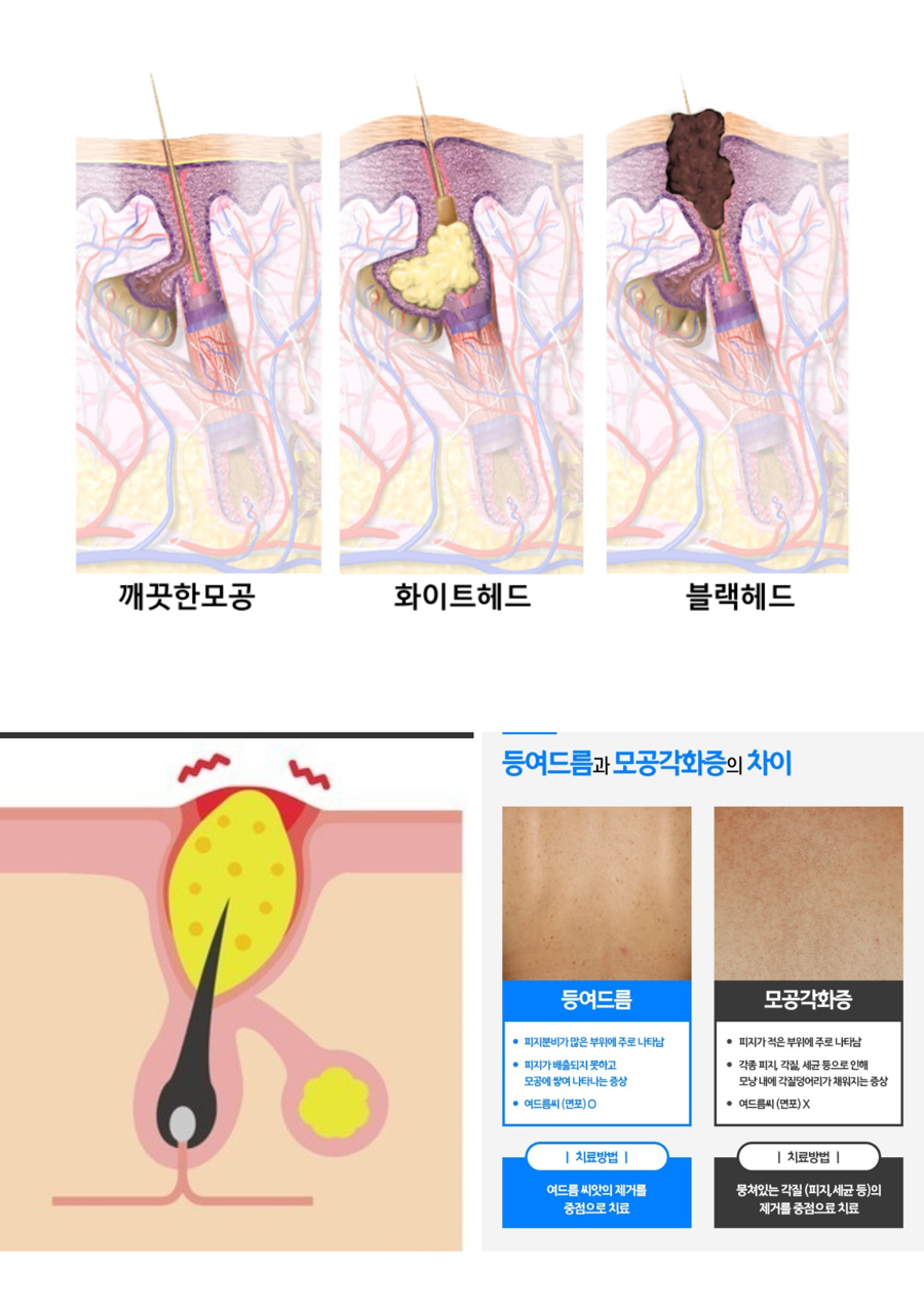 베카로움 이미지