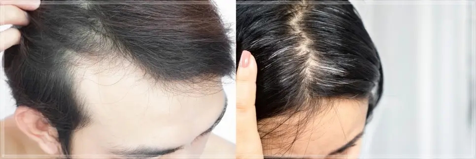 이지안헤어 이미지