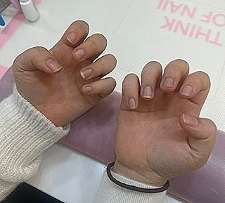 율비네일 이미지