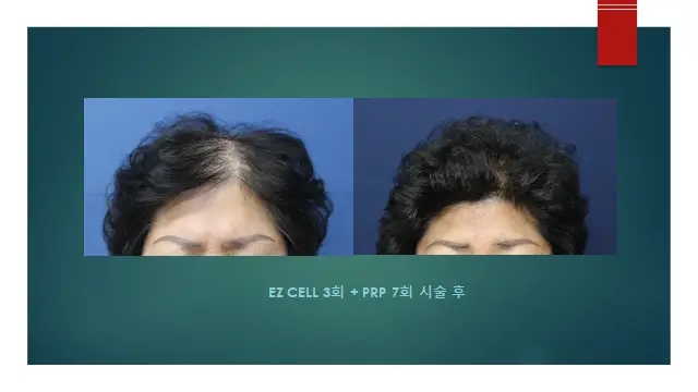 이지성형외과 이미지