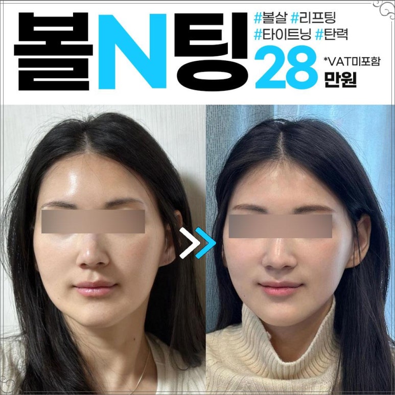 엔비유의원 이미지