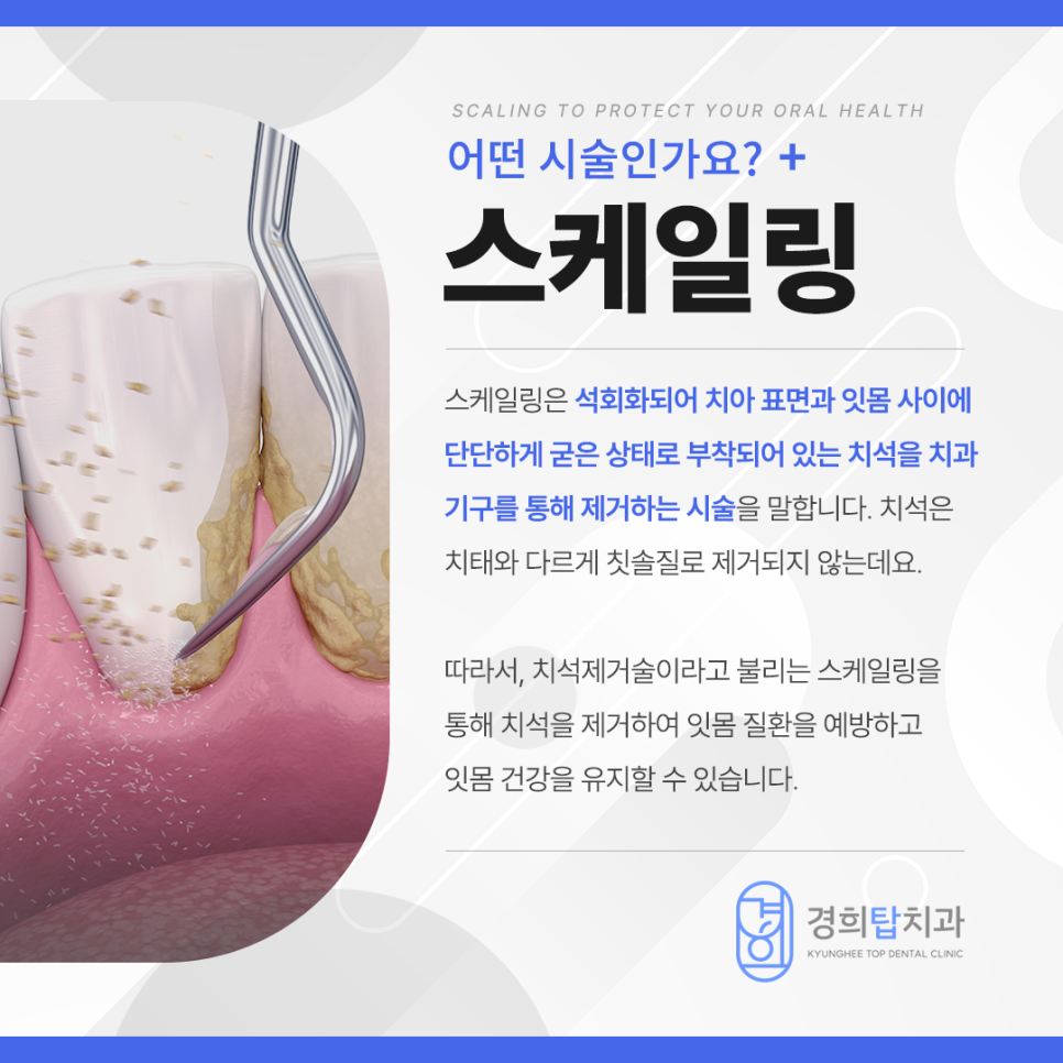 경희탑치과의원 이미지