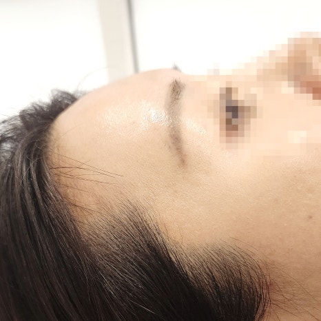 권헤어라인 이미지