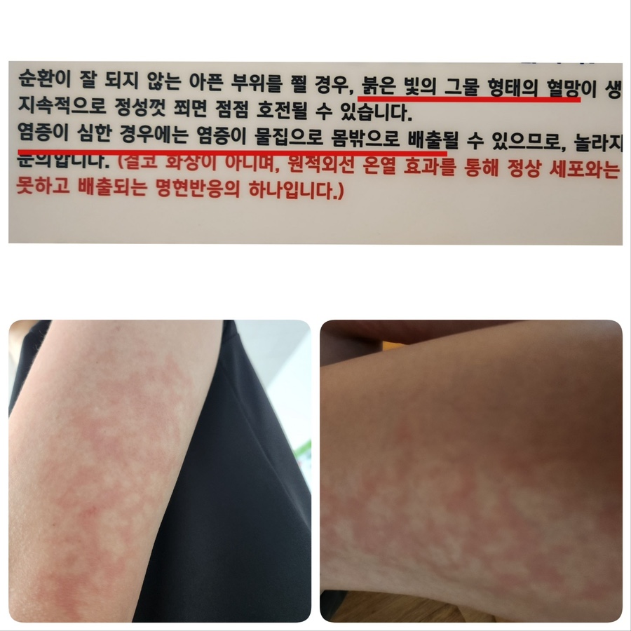 참쉬운다이어트 이미지