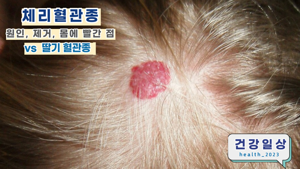 포두반점 이미지