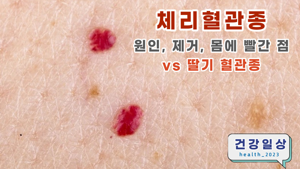 포두반점 이미지