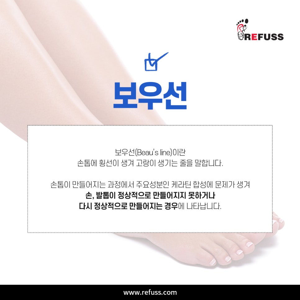 엘앤제이왁싱엔레푸스 이미지