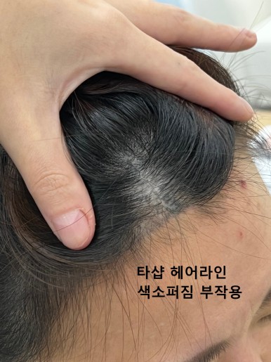 현헤어라인 이미지